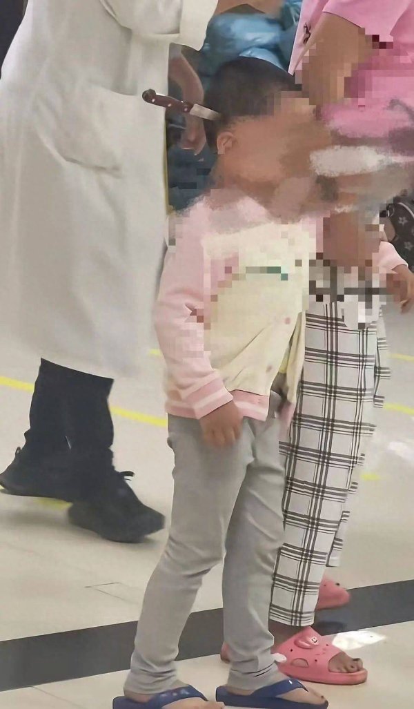 鼎盛配资 3岁女童“头上插刀”淡定就医，医院：已做开颅手术，成功取刀，女童身体情况稳定